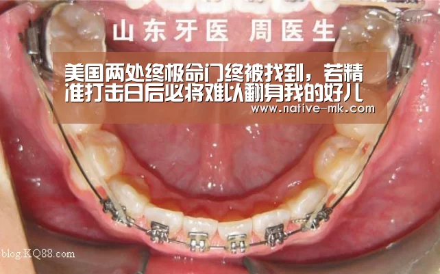 美国两处终极命门终被找到,若精准打击日后必将难以翻身我的好儿媳_mk体育官网(图1) mk体育官方网站
